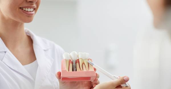 5 Common Myths and Facts About Dental Implants in Garland