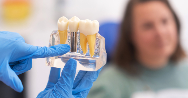 How to Avoid Common Dental Implant Problems in Garland